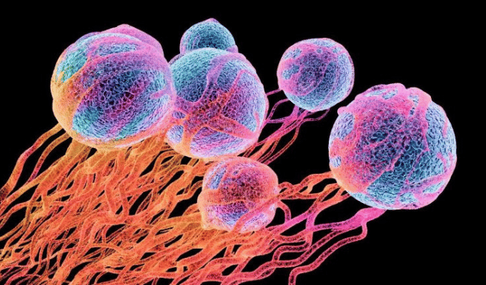 Alarma Mundial: Casos de Cáncer Aumentarán más de un 75% para 2050