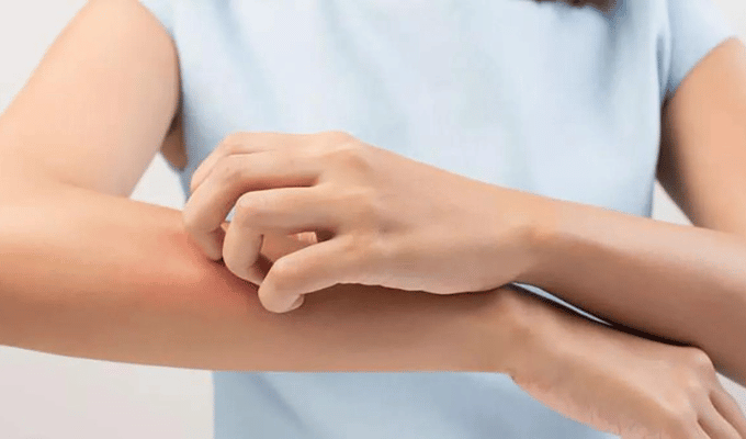 Rascarse: Un Acto Instintivo con Implicaciones Sociales y de Salud