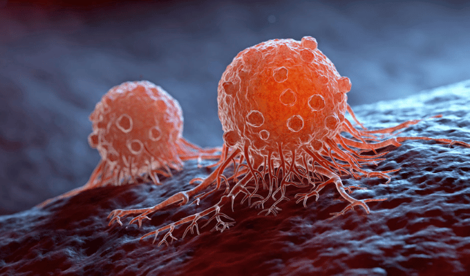 1 de Cada 5 Personas Podría Desarrollar Cáncer Según Estudio Reciente