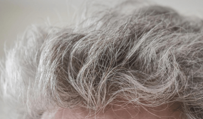 Elimina las Canas: Alimentos y Suplementos para Revitalizar Tu Cabello