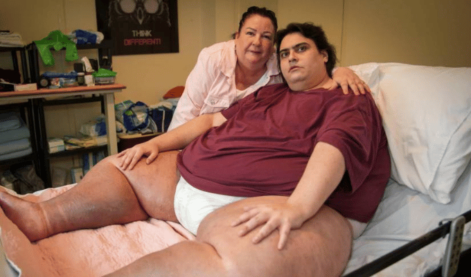 Jason Holton, el hombre más obeso de Gran Bretaña, muere a los 33 años