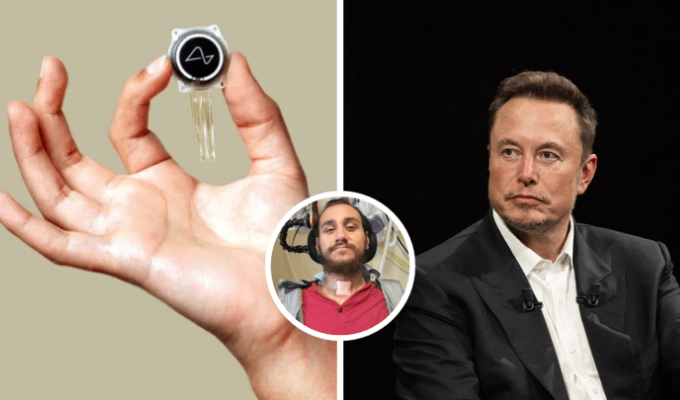 Falla implante de Neuralink: dispositivo pierde conexión en paciente