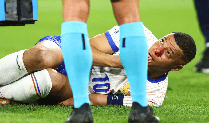 ¡Impacto en la Euro! Mbappé lesionado tras debut tibio