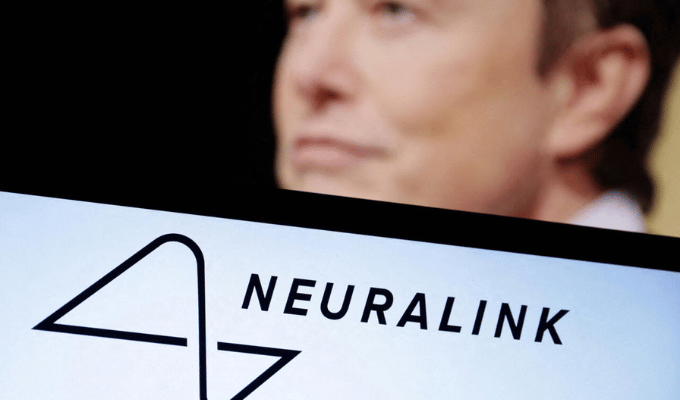 ¡Avance Cerebral! Neuralink implanta segundo chip en humano