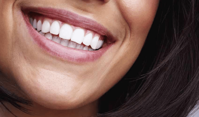 ¿Dientes Amarillos? El Fallo que Todos Cometemos