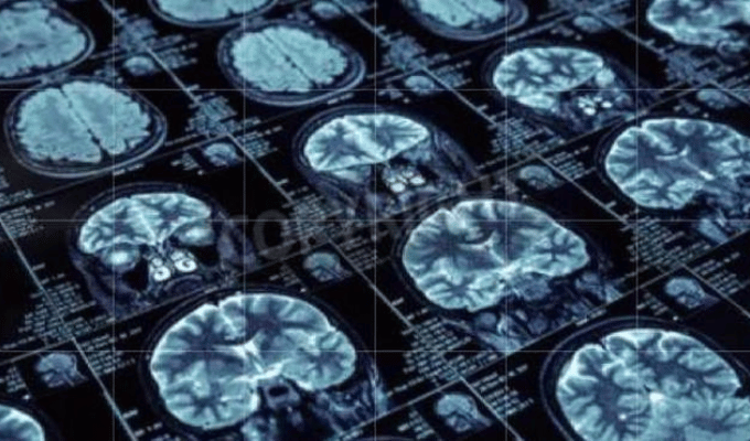 Ciclo menstrual: ¿afecta también el cerebro?