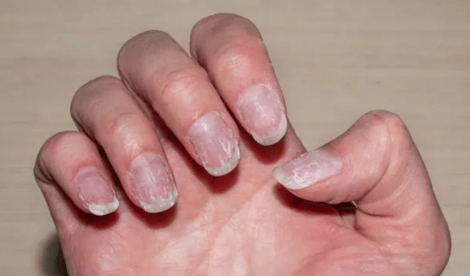 Conoce qué cambios en tus uñas indican problemas de salud