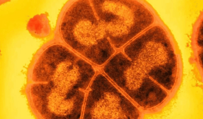 ‘Conan, la bacteria’ resiste 28.000 veces más radiación que un humano