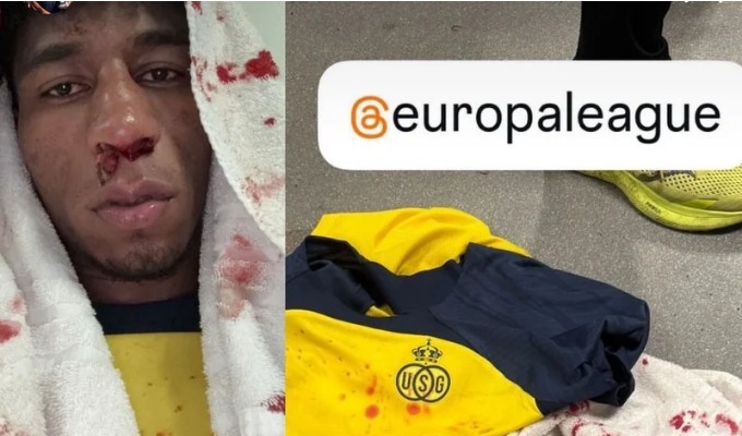 Kevin Rodríguez quedó golpeado tras brutal choque en Europa