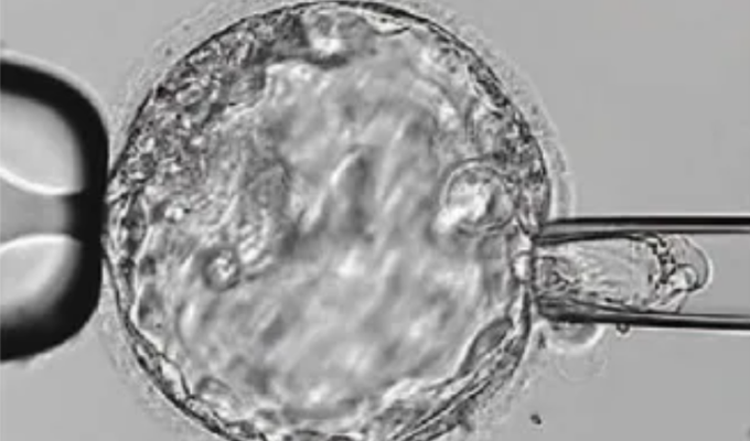 Niños con anomalías congénitas: ¿La medicina reproductiva, solución?