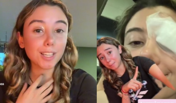 Desmaquillarse con aceite de coco un viaje de TikTok al quirófano