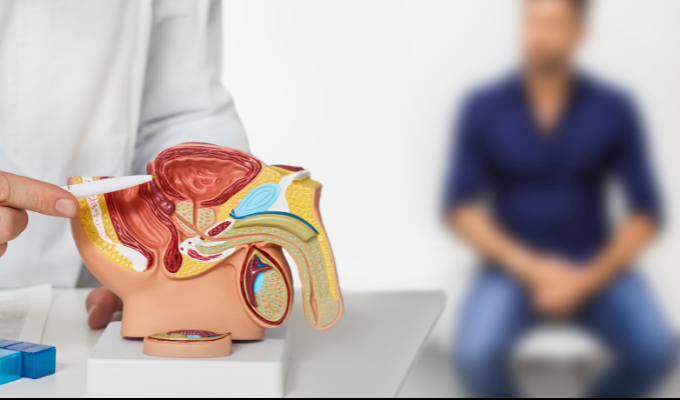 Cáncer de próstata en Ecuador: una amenaza silenciosa
