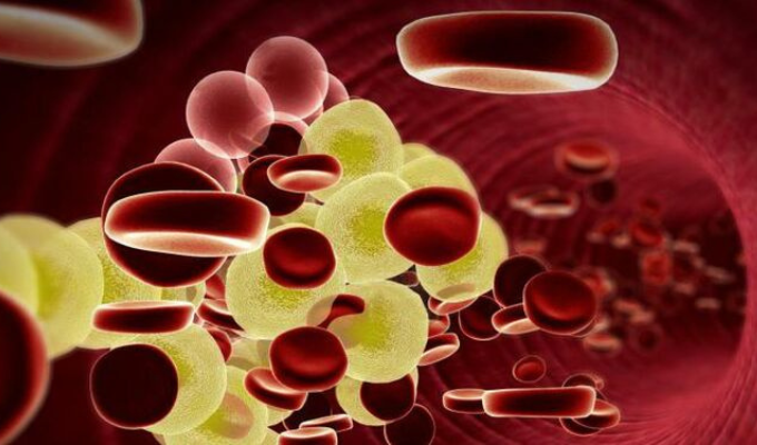 5 consejos infalibles para reducir tu colesterol