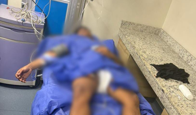 Sujeto terminó herido tras disparar contra la Policía