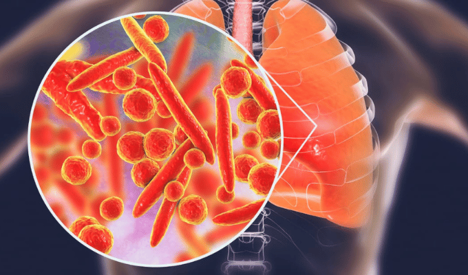 Mycoplasma pneumoniae: la bacteria que se parece al COVID-19