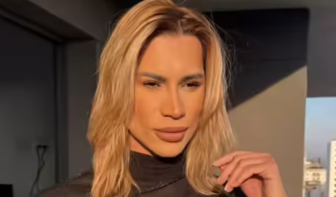 Falleció el influencer brasileño Adair Mendes tras cirugía ‘foxy eyes’