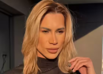 Falleció el influencer brasileño Adair Mendes tras cirugía ‘foxy eyes’