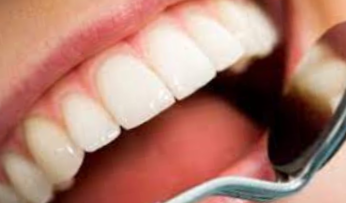El estado de tu lengua podría ser indicativo de varias enfermedades
