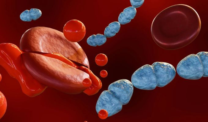 Medicamento contra la sepsis logra resultados alentadores