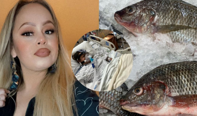 🦠 Bacteria 'carnívora' de un pescado le arrebata extremidades a mujer