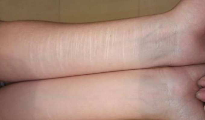 Las razones tras el aumento de "cutting"