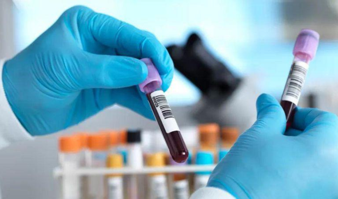 ¿Confías ciegamente en tus resultados Piénsalo dos veces