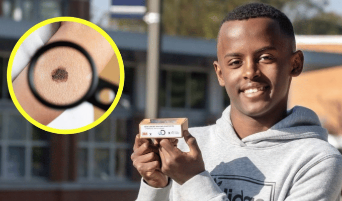 Heman Bekele: El genio adolescente que desafía al cáncer de piel