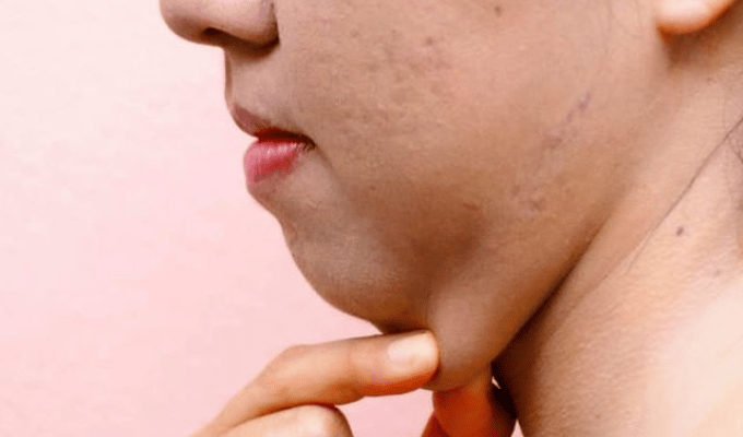Transforma tu rostro: Vitamina E para combatir la papada