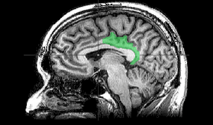 Impacto de los Recuerdos Traumáticos en la Función Cerebral Revelado